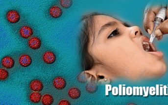 Poliomyelitis Symptoms In Children