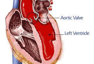 What is Aorta? Aorta Functions and Aortic Diseases