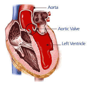 What is Aorta? Aorta Functions and Aortic Diseases