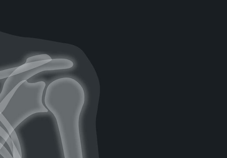 What is The Anatomy Of The Shoulder?