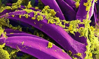 10 Characteristics Of Bacterias - What are bacterias?