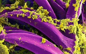 10 Characteristics Of Bacterias - What are bacterias?