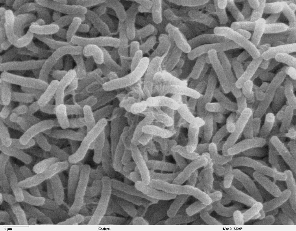 Scanning electron microscope image of Vibrio cholerae
