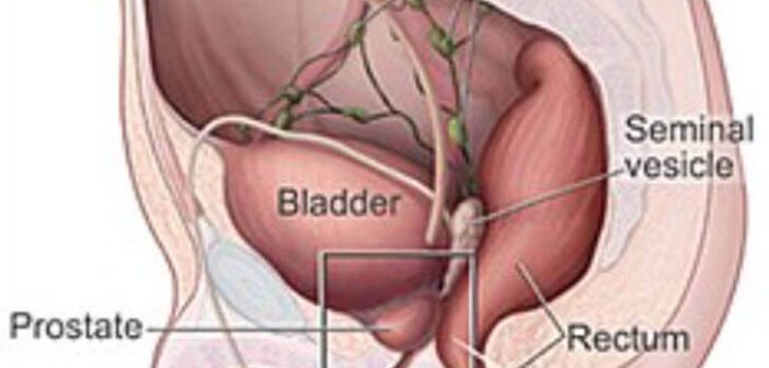 Understanding the Bladder: Anatomy, Function, and Common Disorders